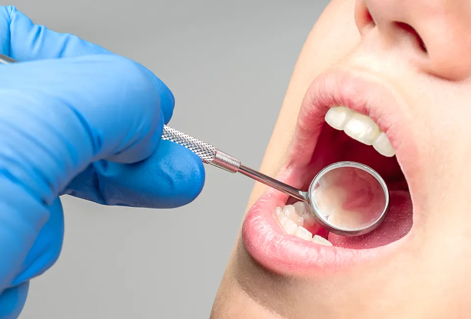 Dental Implants